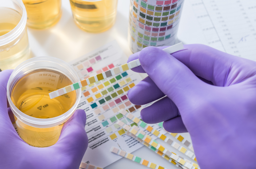 Gloved hands holding a urine sample cup and test strip during a THC drug screening process.